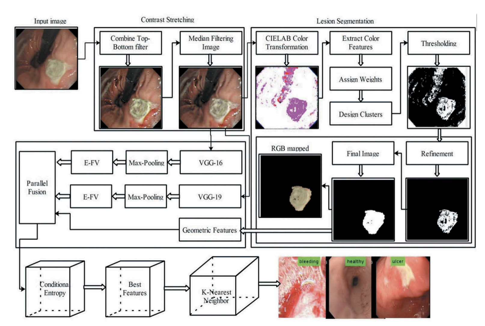 Deep CNN and Geometric Features-Based Gastrointestinal Tract Diseases Detection and Classification from Wireless Capsule Endoscopy Images