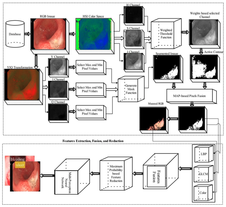 Classification of Gastrointestinal Diseases of Stomach from WCE Using Improved Saliency-Based Method and Discriminant Feature Selection