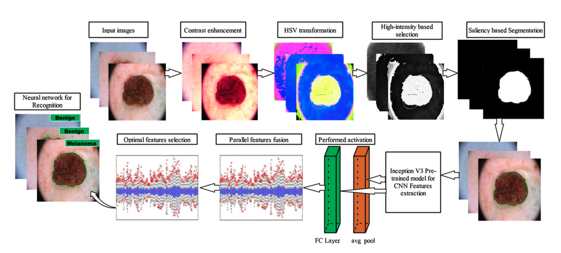An Integrated Framework of Skin Lesion Detection and Recognition through Saliency Method and Optimal Deep Neural Network Feature Selection