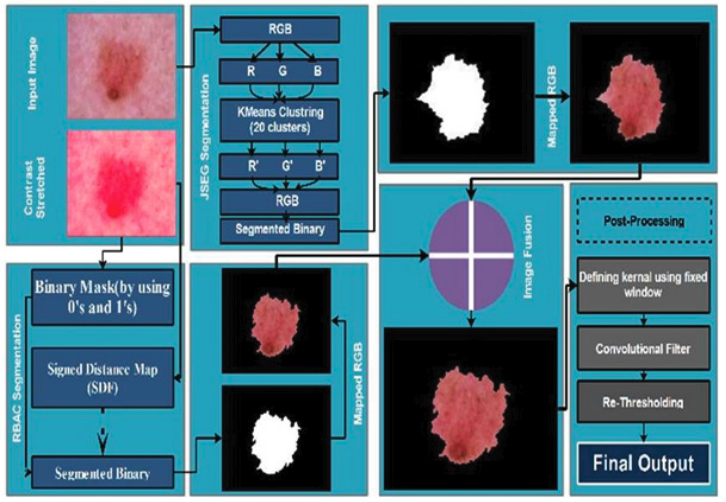 Region-Based Active Contour JSEG Fusion Technique for Skin Lesion Segmentation from Dermoscopic Images