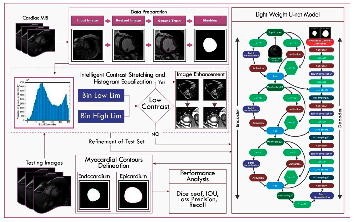 A Novel Light U-Net Model for Left Ventricle Segmentation Using MRI